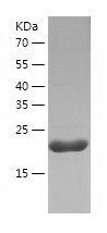 Recombinant Human MCTS1/人源MCTS
