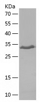 Recombinant Human DRD5/人源DRD5蛋