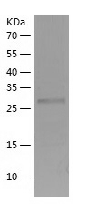 Recombinant Human TTC33/人源TTC3