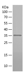 Recombinant Human SMN1/人源SMN1蛋