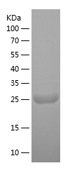 Recombinant Human MYL4/人源MYL4蛋
