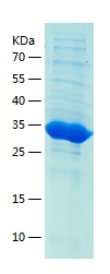 Recombinant Human GNPDA1/人源GNP