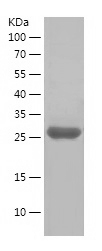 Recombinant Human ERBB3/人源ERBB