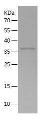 Recombinant Human GOLPH3/人源GOL