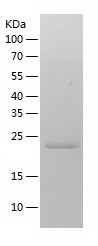 Recombinant Human RAB2B/人源RAB2