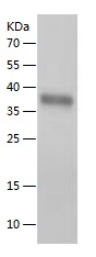 Recombinant Human Azurocidin/人