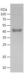 Recombinant Human MLH1/人源MLH1蛋