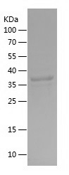 Recombinant Human SQSTM1/人源SQS