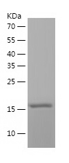 Recombinant Human SCO1/人源SCO1蛋