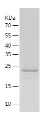 Recombinant Human NUDT21/人源NUD