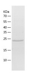 Recombinant Human CHRNA3/人源CHR