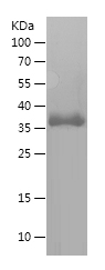 Recombinant Human COL3A1/人源COL