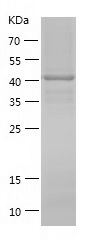 Recombinant Human AHCYL1/人源AHC