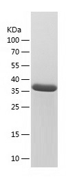 Recombinant Human ENTPD1/人源ENT