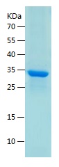 Recombinant Human Cdk4/人源Cdk4蛋
