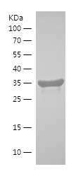 Recombinant Human RAB1B/人源RAB1