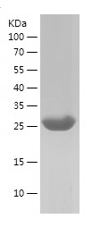 Recombinant Human PTK2/人源PTK2蛋