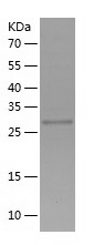 Recombinant Human ZNF268/人源ZNF