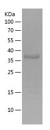 Recombinant Human NFATC3/人源NFA