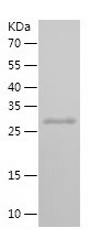 Recombinant Human SMAD4/人源SMAD