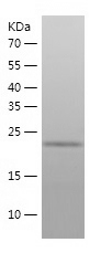 Recombinant Human UBE2R2/人源UBE