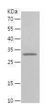 Recombinant Human ATP5MG/人源ATP