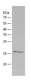 Recombinant Human ADAM21/人源ADA