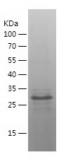 Recombinant Human CDX2/人源CDX2蛋