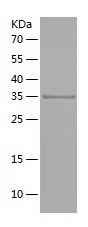 Recombinant Human NDUFAF1/人源ND