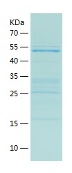 Recombinant Human ADSS2/人源ADSS