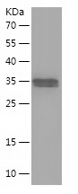 Recombinant Human MT1G/人源MT1G蛋
