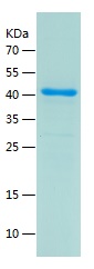 Recombinant Human MDM4/人源MDM4蛋