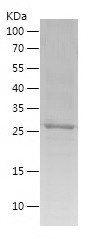 Recombinant Human CA3/人源CA3蛋白