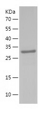 Recombinant Human GTPBP4/人源GTP