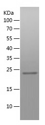 Recombinant Human ZC3HAV1/人源ZC