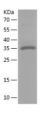 Recombinant Human RCN3/人源RCN3蛋