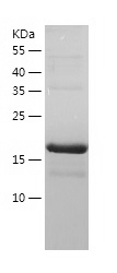 Recombinant Human UBE2C/人源UBE2
