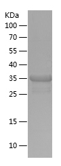 Recombinant Human RIOK3/人源RIOK