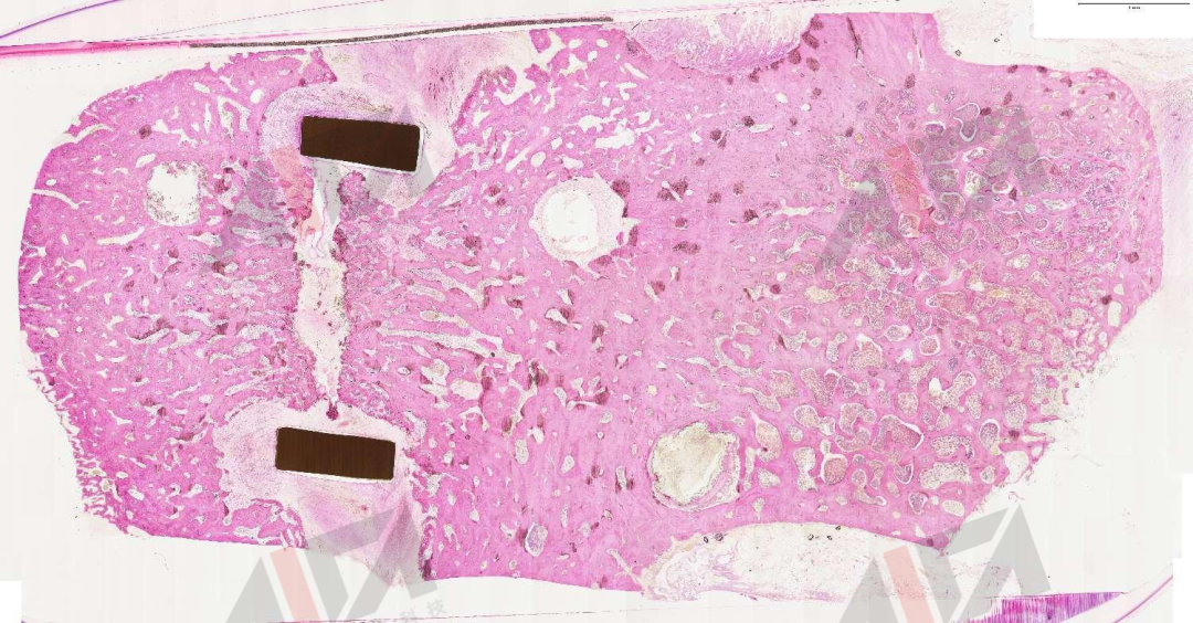 艾佧科技硬组织切磨片图例