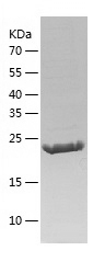 Recombinant Human RAB38/人源RAB3