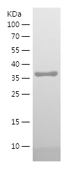 Recombinant Human S1-1/人源S1-1蛋