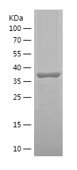 Recombinant Human STT3A/人源STT3