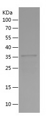 Recombinant Human NR2E3/人源NR2E