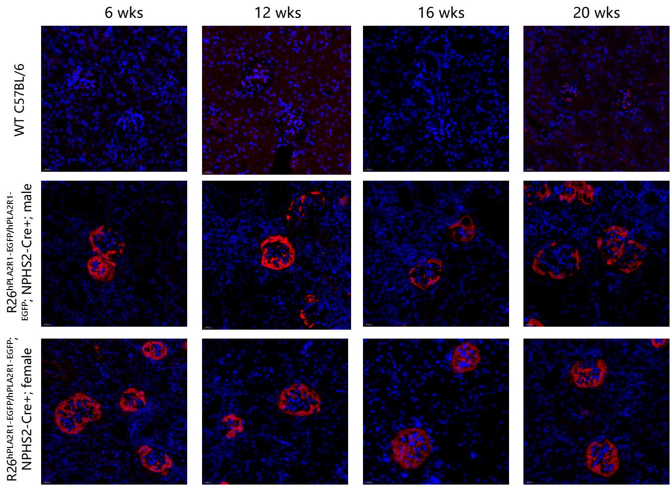 瞄准PLA2R1！无需干预，南模生物自发膜性肾病模型