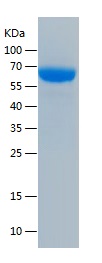 Recombinant Human PSG1/人源PSG1蛋