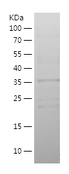 Recombinant Human NRDE2/人源NRDE