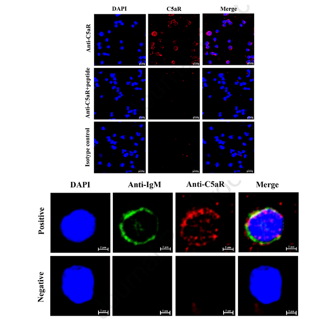 AtaGenix专业蛋白表达与抗体定制服务，助力草鱼C5a-CP佐剂研究