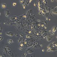 浙江美森-鳞状细胞癌,扁平上皮癌细胞 SNU-46