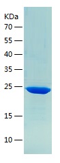 Recombinant Human HSPB1/人源HSPB