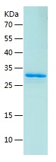 Recombinant Human DKK2/人源DKK2蛋